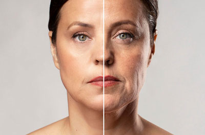 skin rejuvenation جوان سازی پوست صورت